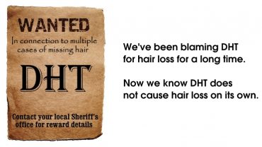 DHT and Hair Loss