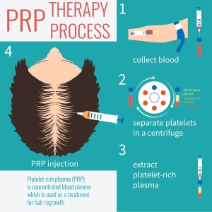 PRP Hair restoration steps