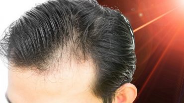 Low level Laser Light Therapy Hair Growth
